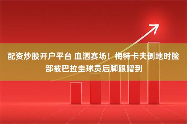 配资炒股开户平台 血洒赛场！梅特卡夫倒地时脸部被巴拉圭球员后脚跟蹭到
